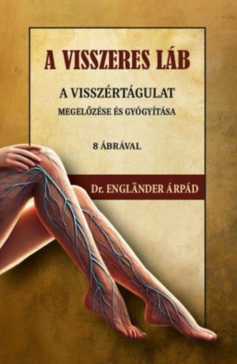 A visszeres láb a visszértágulat megelőzése és gyógyítása termékhez kapcsolódó kép