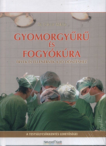 Gyomorgyűrű és fogyókúra - Érvek és ellenérvek a jó döntéshez termékhez kapcsolódó kép