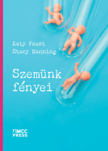 Szemünk fényei termékhez kapcsolódó kép
